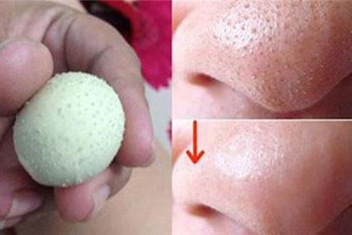 Sạch mụn đầu đen chỉ bằng cách dùng trứng gà