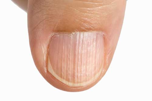 Những dấu hiệu cảnh báo cơ thể đang bị thiếu protein nghiêm trọng