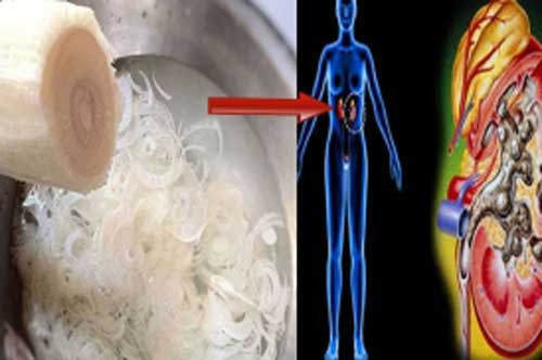 Cách ăn lõi chuối để tiêu sỏi thận và giảm cân "cấp tốc"