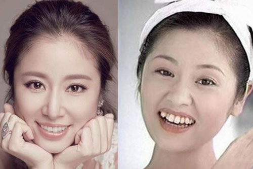 'Giật mình' với những hàm răng khấp khểnh kém duyên của sao Hoa ngữ