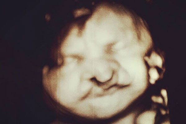 Mẹ trẻ trào nước mắt khi nhận điều bất ngờ từ người lạ dành cho con trai dị tật