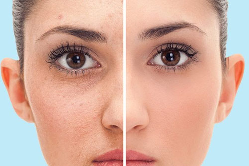 5 tác dụng tuyệt vời cho da khi tắm nước mát