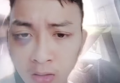 Hoài Lâm nói gì về hình ảnh 'như ngáo đá'?