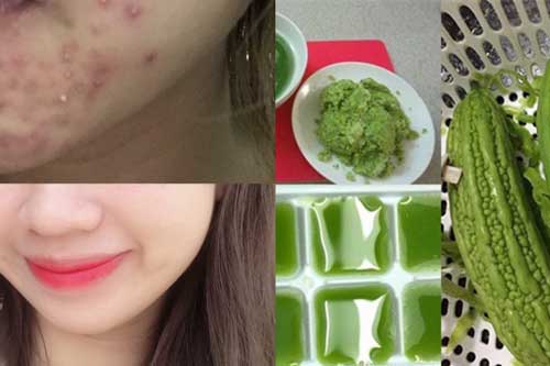 Lấy nước ép mướp đắng đông đá thoa lên vùng da bị mụn nặng, cô gái trẻ giật mình với kết quả không ngờ