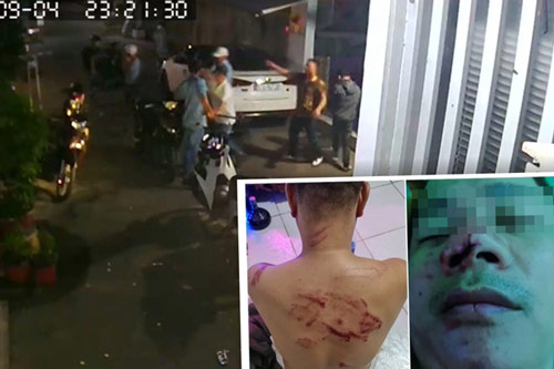 TP.HCM: Hơn 10 đối tượng xông vào nhà đánh, chém người