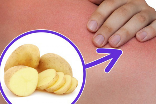 Những bài thuốc Đông y có sẵn trong bếp, trị bệnh cực tốt mà không tốn tiền