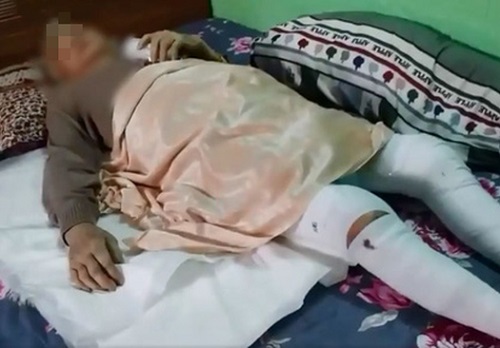 Cụ bà 82 tuổi quê Bình Định vượt qua 'tử thần' một cách ngoạn mục