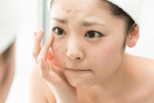 Chăm sóc da cho chị em U30 dễ dàng hơn với các cách sau