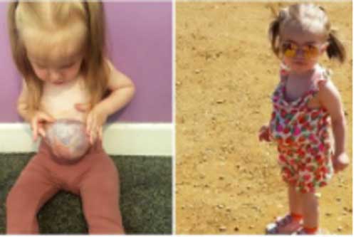 Hi hữu: Bé gái sinh ra có nội tạng bên ngoài cơ thể