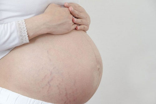 Mách chị em 5 bí kíp chống rạn da khi mang bầu, giữ lại làn da bụng mềm mại như thời con gái
