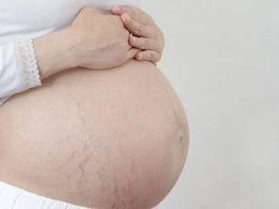 Mách chị em 5 bí kíp chống rạn da khi mang bầu, giữ lại làn da bụng mềm mại như thời con gái
