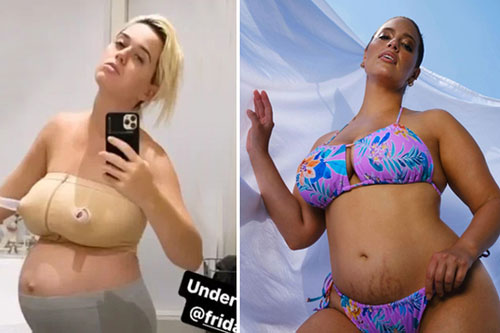 Các sao không ngại lộ bụng xấu sau sinh