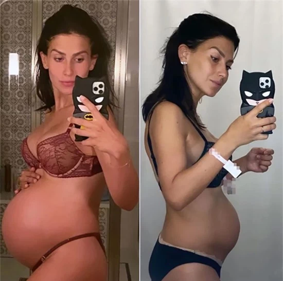 Hilaria Baldwin - vợ của tài tử Trân Châu cảng Alec Baldwin - đăng ảnh trước khi đi đẻ (trái) và lúc vừa ở viện về nhà vào đầu tháng 9. Người đẹp 36 tuổi vừa sinh con thứ 5 với Alec. Hilaria dành lời tri ân cơ thể của mình vì hành trình gian nan nhưng tuyệt vời vừa trải qua.