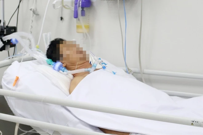Một bệnh nhân bị ngộ độc pate Minh Chay điều trị tại Bệnh viện Chợ Rẫy. Ảnh: BVCC.