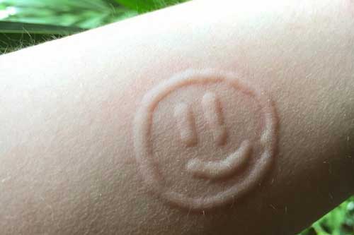 Mắc căn bệnh lạ, cô gái trẻ biến da mình thành những bức tranh thú vị