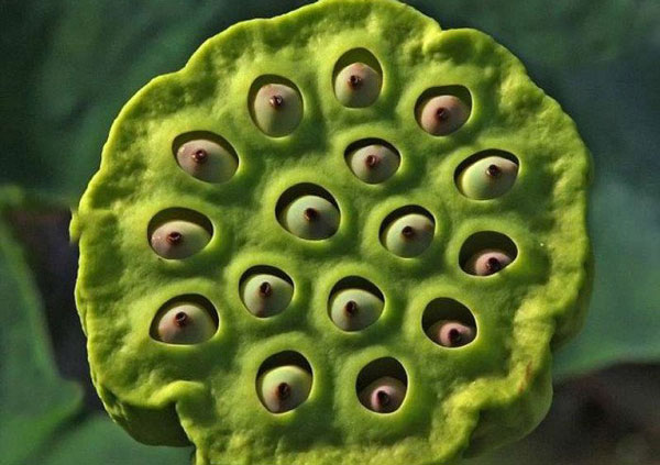 Giải mã nguyên nhân của 'hội chứng sợ lỗ' gây ám ảnh cho hàng tỷ người