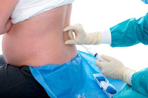 Mũi tiêm 'đẻ không đau' có ảnh hưởng gì không?