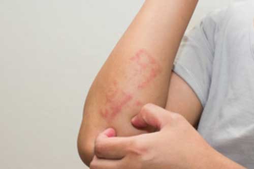 Thấy ngứa mắt ngứa tai chứng tỏ cơ thể đang có bệnh, cần đi khám gấp