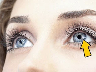 Những thực phẩm tốt cho mắt