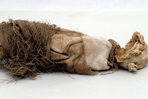 Xác ướp một bào thai hé lộ quy trình phẫu thuật thời cổ xưa