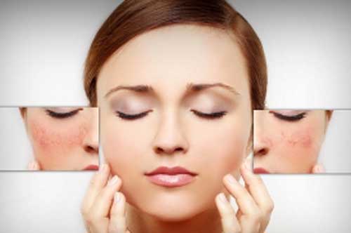 'Xóa bay' sẹo lâu năm chỉ với mẹo 3 đơn giản không phải ai cũng biết