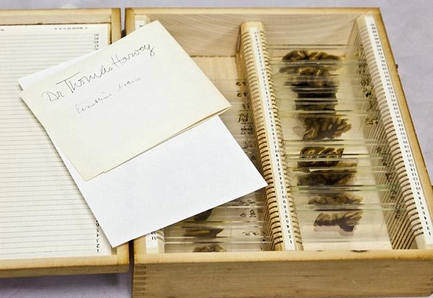 Chuyện ly kỳ về bộ não bị đánh cắp của thiên tài Einstein