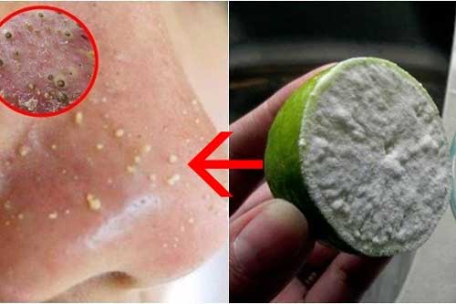 Chà chanh lên mặt theo cách này mụn biến mất, da trắng bóc