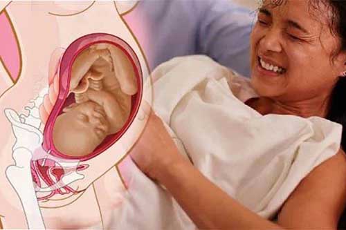 Dấu hiệu bà bầu chuyển dạ sắp sinh chính xác nhất, ai cũng cần biết