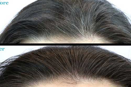 Trị tận gốc nỗi lo tóc bạc sớm nhờ "thần dược" siêu rẻ này