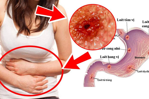 Trước và sau khi ngủ không làm điều này, bạn sẽ đối diện nguy cơ ung thư dạ dày và cổ họng cực cao