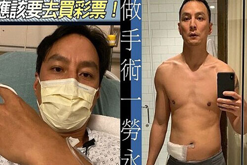 Ngô Ngạn Tổ suýt chết vì viêm ruột thừa