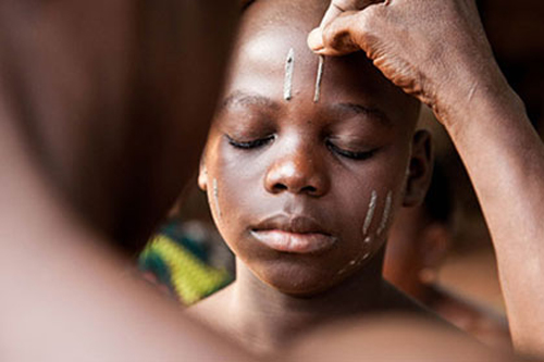 'Rùng rợn' tục tạo vết sẹo lên cơ thể để... làm đẹp