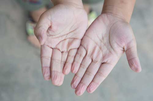 Vì sao da ngón tay bị nhăn nheo khi ngâm lâu trong nước?