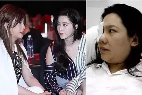 Triệu Vy mất 17 năm để tha thứ cho Phạm Băng Băng, nhưng có một người phụ nữ cả đời này cô sẽ không bao giờ tha thứ