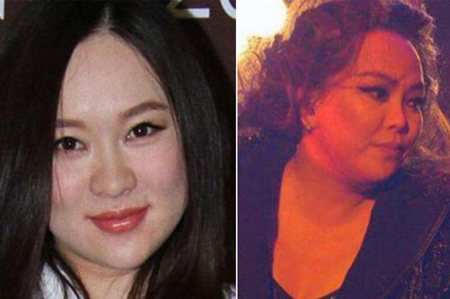 Mỡ đã 'phá hỏng' khuôn mặt của 4 sao nữ