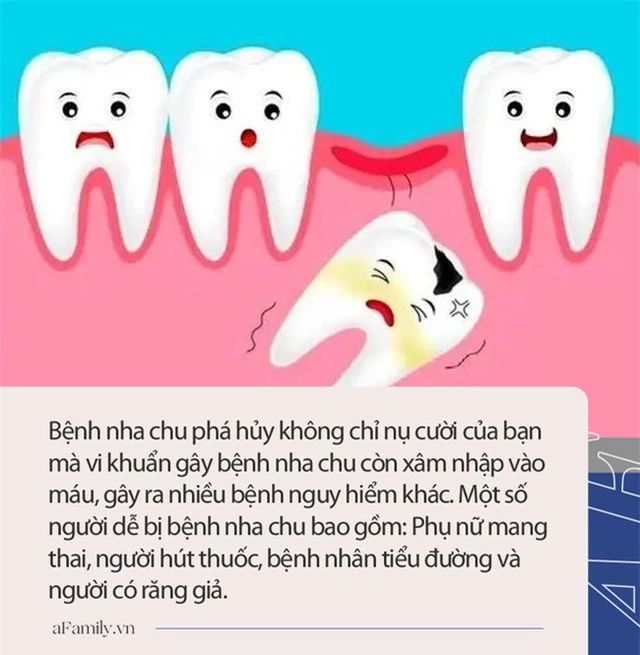 Người đàn ông 31 tuổi đi khám vì răng lung lay, bác sĩ quyết định nhổ tất cả răng vì sai lầm từ 2 năm trước của anh - Ảnh 2.