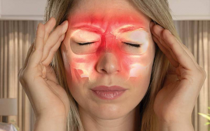 Điểm mặt 5 nguyên nhân gây bệnh viêm xoang thường gặp nhất