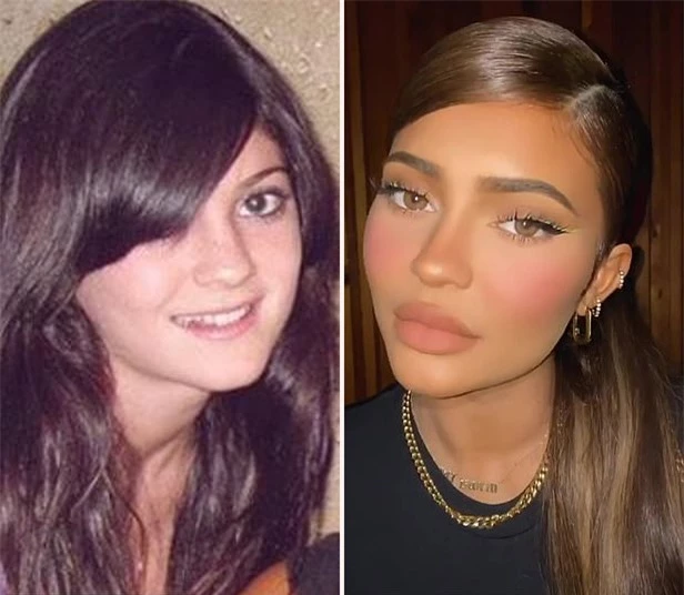 Kylie Jenner năm 2009 (trái) và hiện tại.