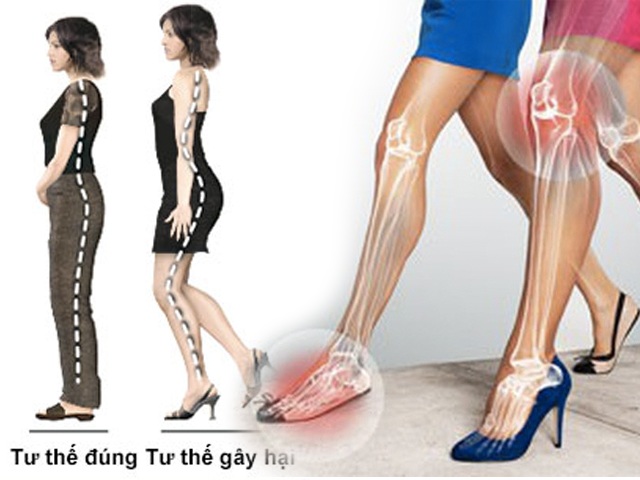 Tất cả thông tin hữu ích cho chị em khi đi giày cao gót để không hại sức khỏe