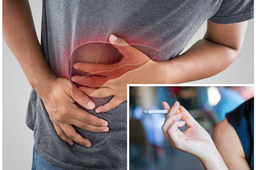 Chỉ mặt "sát thủ" hại gan mỗi ngày, nhiều người vẫn "đón" vào người mà không biết