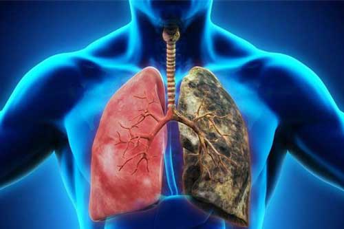 Những thực phẩm là "sát thủ" hại phổi không kém gì khói độc