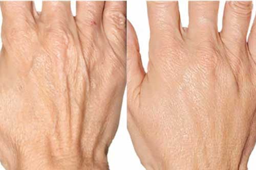 Khắc phục da tay nhăn nheo gân guốc với những nguyên liệu "nhà nào cũng có"