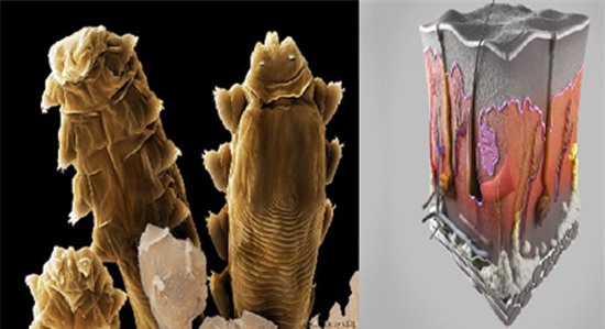 Bí ẩn loài vật '8 chân' sống trên mặt người mà không thể 'tiêu diệt'