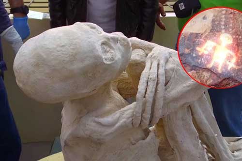 Bí ẩn giật mình về xác ướp chỉ có 3 ngón tay