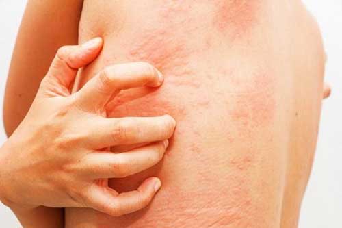 Bỗng thấy ngứa 7 vị trí này trên cơ thể, hãy đi khám ngay vì nó cảnh báo bạn đang mắc bệnh nguy hiểm