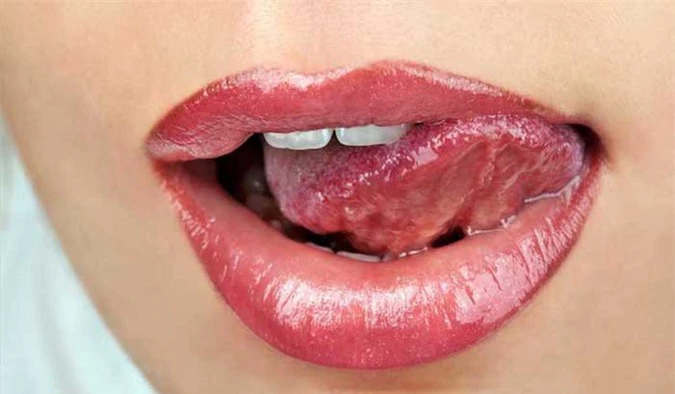 Bệnh lây truyền qua đường hô hấp: Hôn môi hay mớm cơm cho trẻ cũng có thể làm nhiễm bệnh - Ảnh 2.