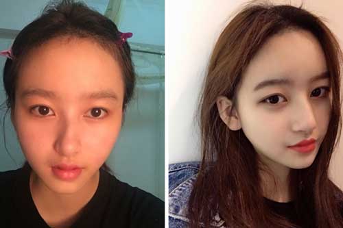 Chùm ảnh: Những cô gái "hoá thành" hot girl nhờ "dao kéo" đúng chỗ