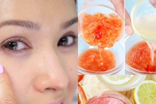 Trẻ hơn 10 tuổi nhờ dùng hỗn hợp rẻ tiền này đánh bay quầng thâm, bọng mắt