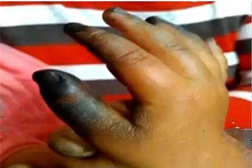 Bí ẩn việc trộm phần thi thể người chết vì sét đánh và sự thật 'ngỡ ngàng'