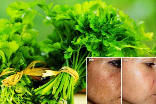 Không còn lo vết thâm, nám tàn nhang nữa khi đã có "thần dược" siêu rẻ này trong bếp